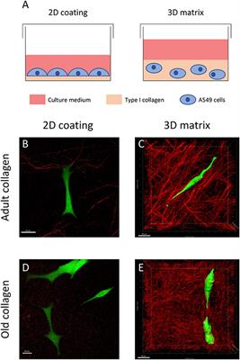 Type I Collagen Aging Increases Expression and Activation of EGFR and Induces Resistance to Erlotinib in Lung Carcinoma in 3D Matrix Model